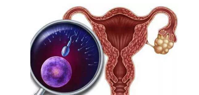 女性健康危机：卵巢癌来袭，专家教您如何破解