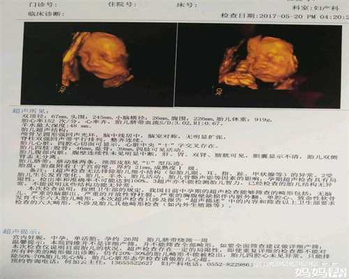 怀孕2个月症状-在线图片欣赏