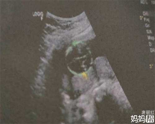武汉代孕招聘网试管婴儿期间可以同房吗？