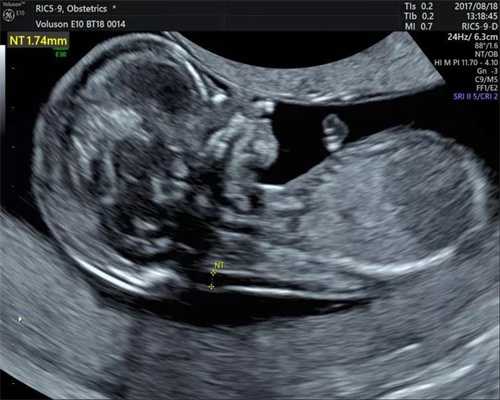 武汉有合法代怀孕代孕期间有没有同房，对胎儿