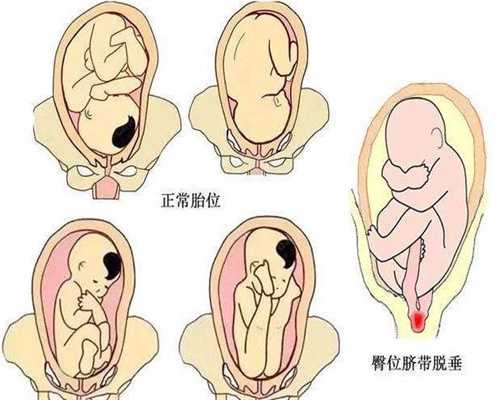 武汉家园试管助孕：夫妻生活能促睾3件常被男性
