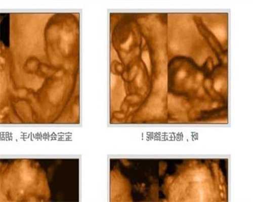 武汉供卵选性别：怀孕后能玩电脑吗-电脑辐射对
