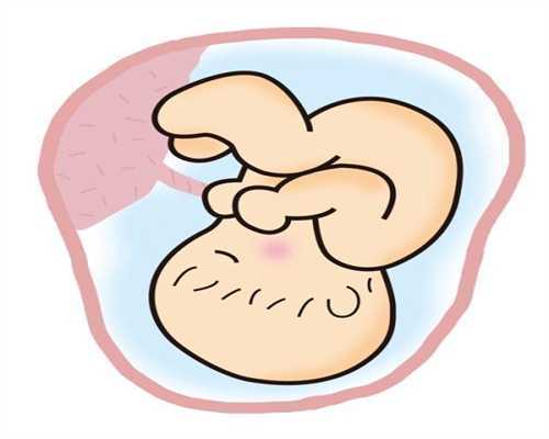 武汉代孕协议：慢性盆腔炎能怀孕吗？